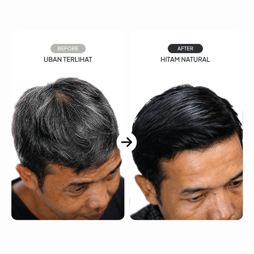 before after tezzen black mamba
